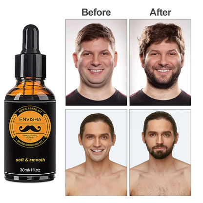 Beard Care Kit for Men